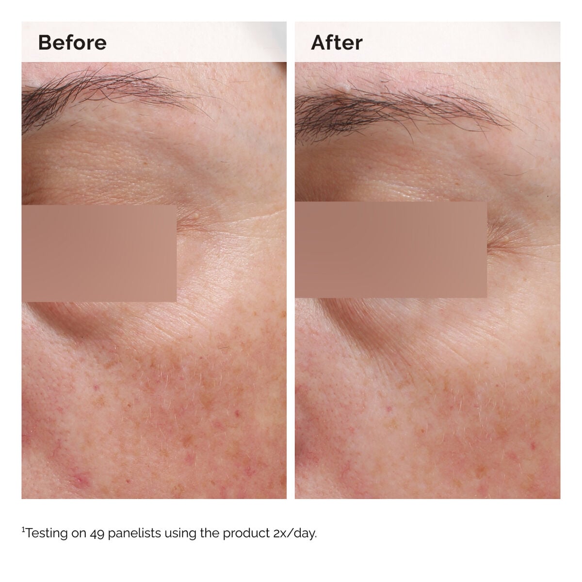 niacinamide-5-face-and-body-emulsion-n2 2024-08-23-ORD-Nia-5pct-Face-Body-B-A-Elasticity-Global-02-1x1.jpg