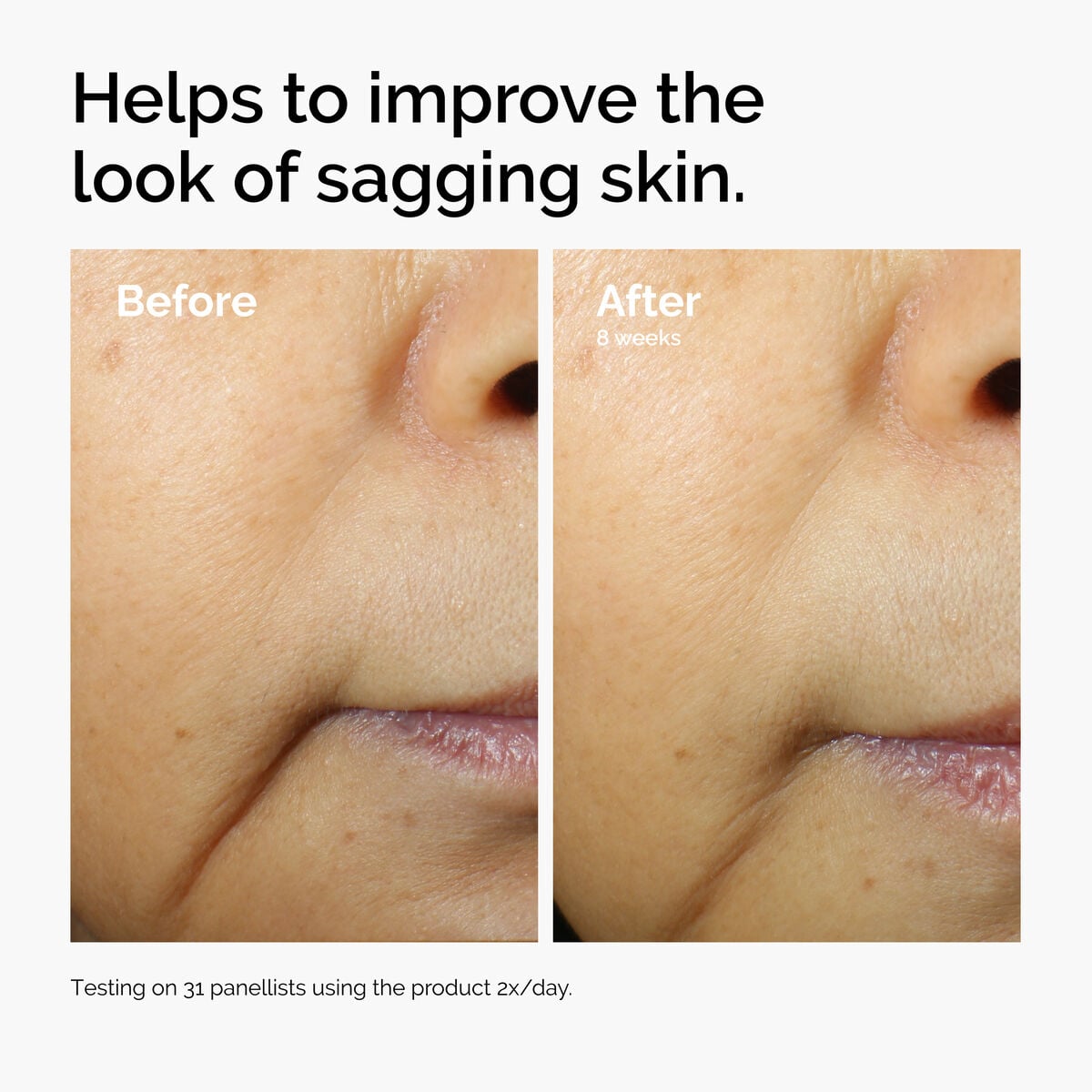 caffeine-3-escin-1-face-serum-z0 ord-caffeine-3pct-escin-1pct-face-serum-before-after-sagging.jpg