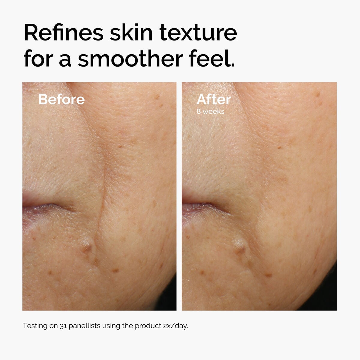 caffeine-3-escin-1-face-serum-z0 ord-caffeine-3pct-escin-1pct-face-serum-before-after-texture.jpg