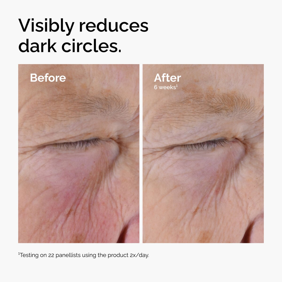 caffeine-solution-5-egcg-eye-serum-p6 ord-caffeine-solution-egcg-dark-circles-before-after.jpg