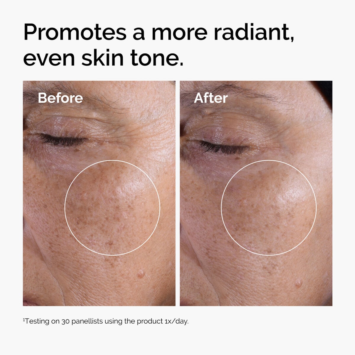glycolic-acid-7-exfoliating-toner-e7 ord-glycolic-before-after-radiance.jpg
