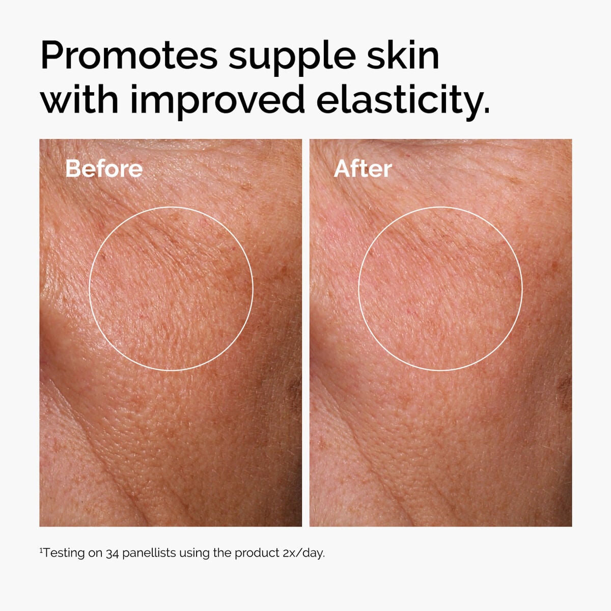 hyaluronic-acid-2-b5-with-ceramides-a3 ord-hyaluronic-acid-2pct-b5-hydrating-serum-before-after-elasticity.jpg