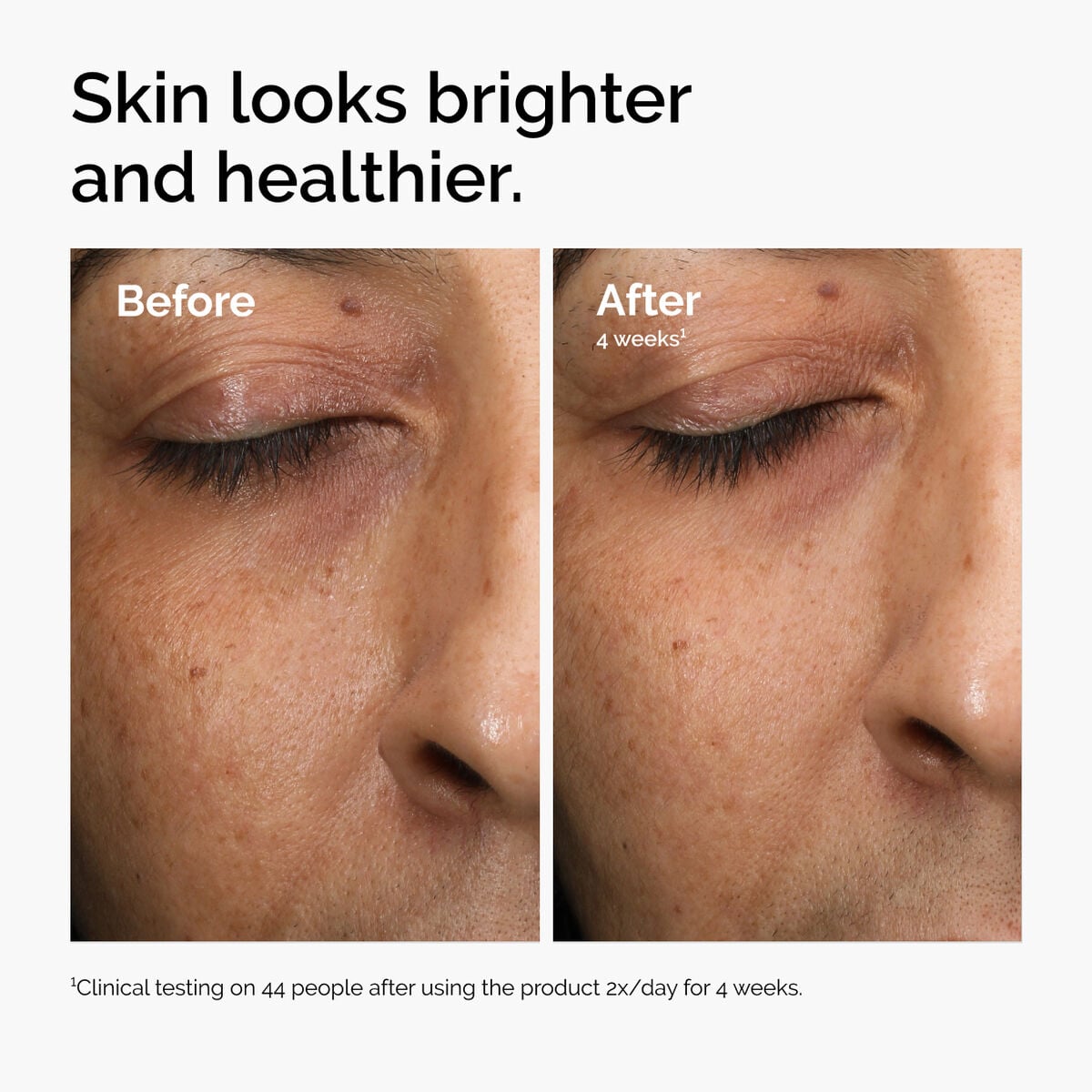 multi-antioxidant-radiance-serum-l1 ord-mars-before-after-healthy.jpg