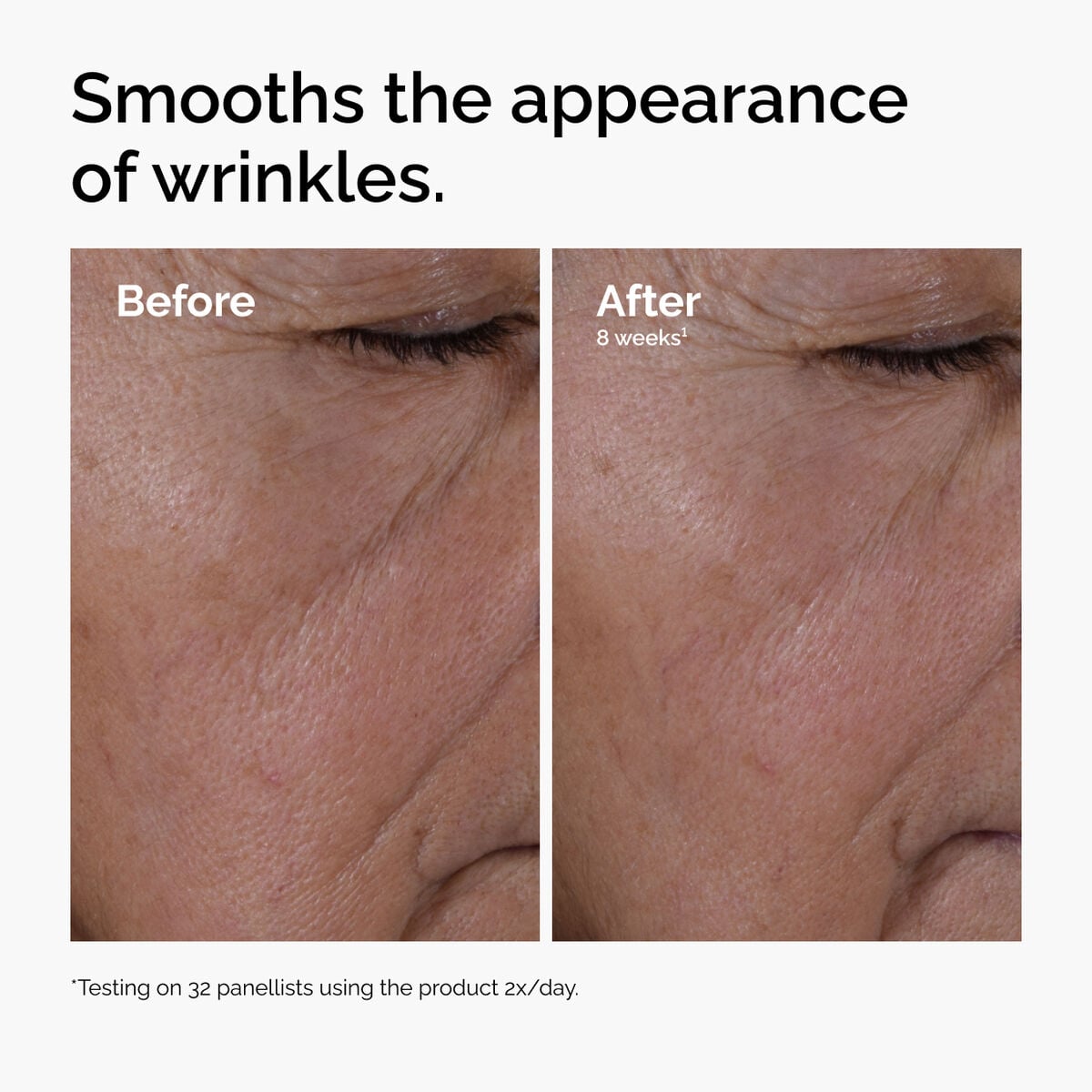 multi-peptide-ha-serum-j1 ord-multi-peptide-ha-serum-wrinkles-before-after.jpg