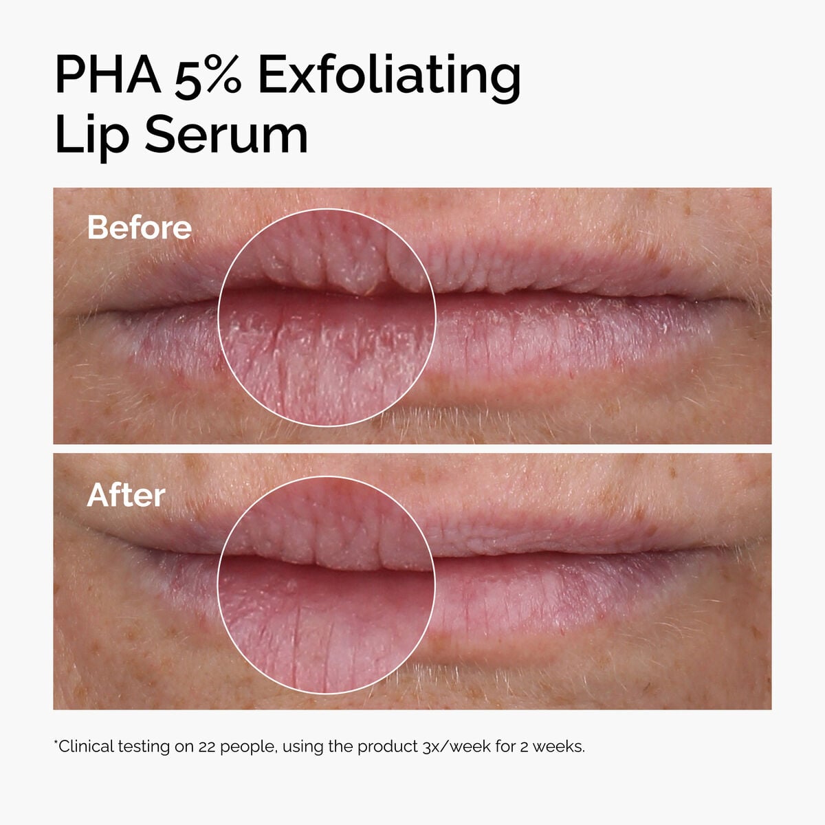 pha-5-exfoliating-lip-serum-y1 ord-pha-5pct-lip-exfoliating-serum-before-after.jpg