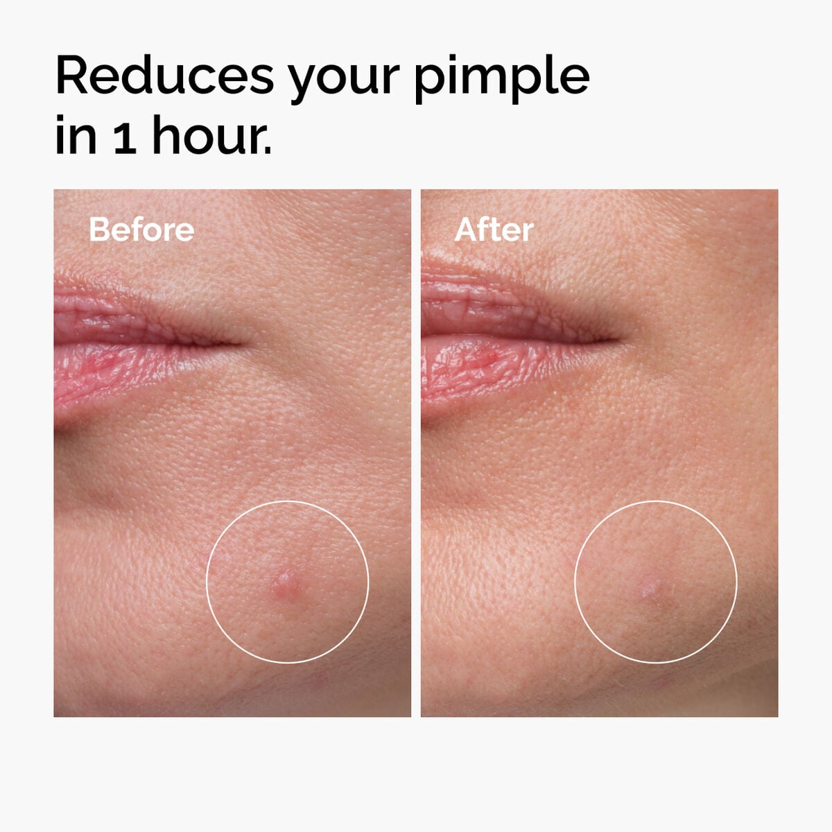 sulfur-10-powder-to-cream-concentrate-w0 ord-sulfur-10pct-powder-to-cream-concentrate-before-after-NA.jpg